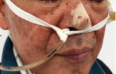 胃管的视频,轻松掌握护理技巧